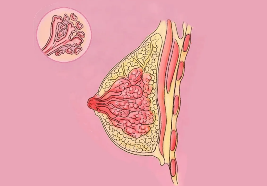 乳腺增生吃什么药最好【药物治疗】