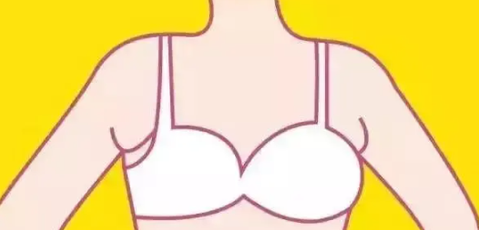 棕南医院副乳切除